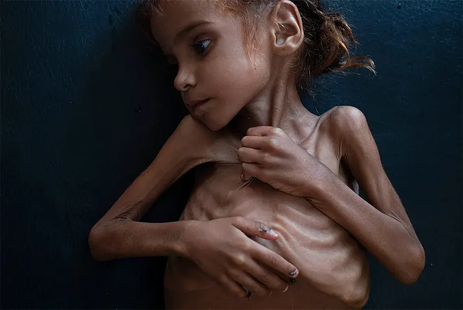 «Амаль Хусейн»
Фото: Tyler Hicks for The New York Times / Pictures of the Year International