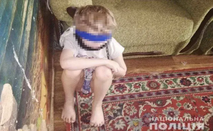 В Днепре мать держала 8-летнего ребенка на цепи.