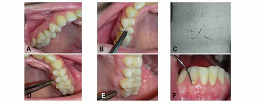 Фото: Zhurakivska etal., OOOOJournal, 2020