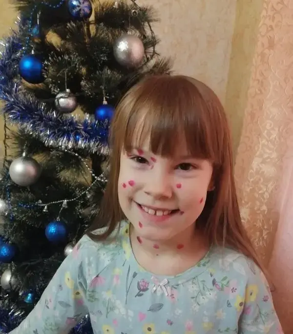 Новый год с ветрянкой. Фото Олеси Соколовой.