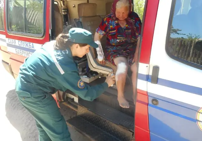 Хозяйка дома получила ожоги