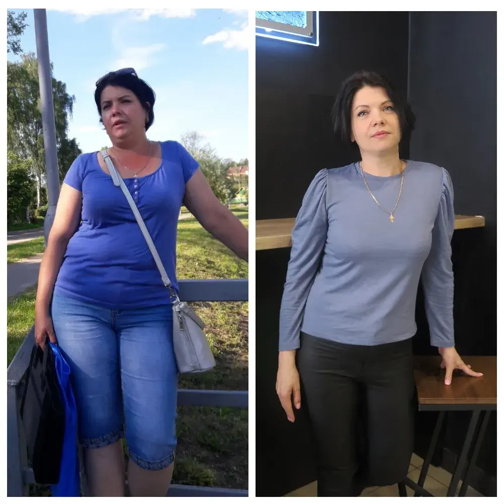 Реальная история похудения, перевернувшая жизнь: фото до и после - Я Покупаю